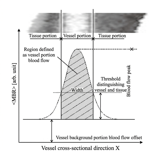 Diagram on calculating for RFV