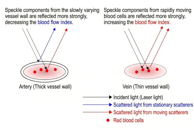 Scattered light by vessel and red cells