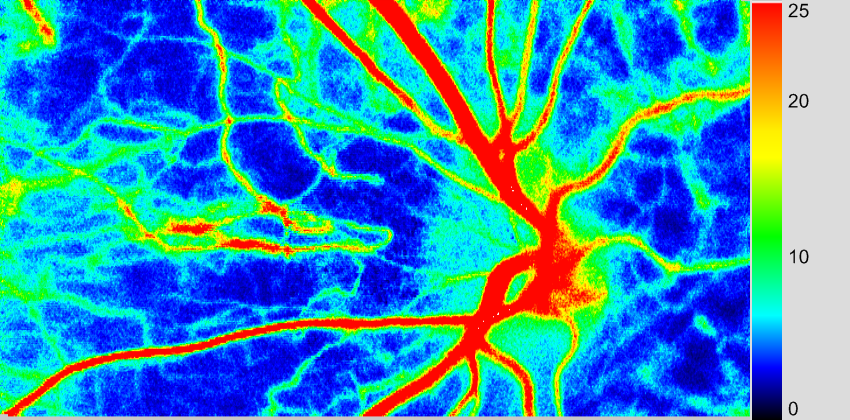 眼底血流マップサンプル