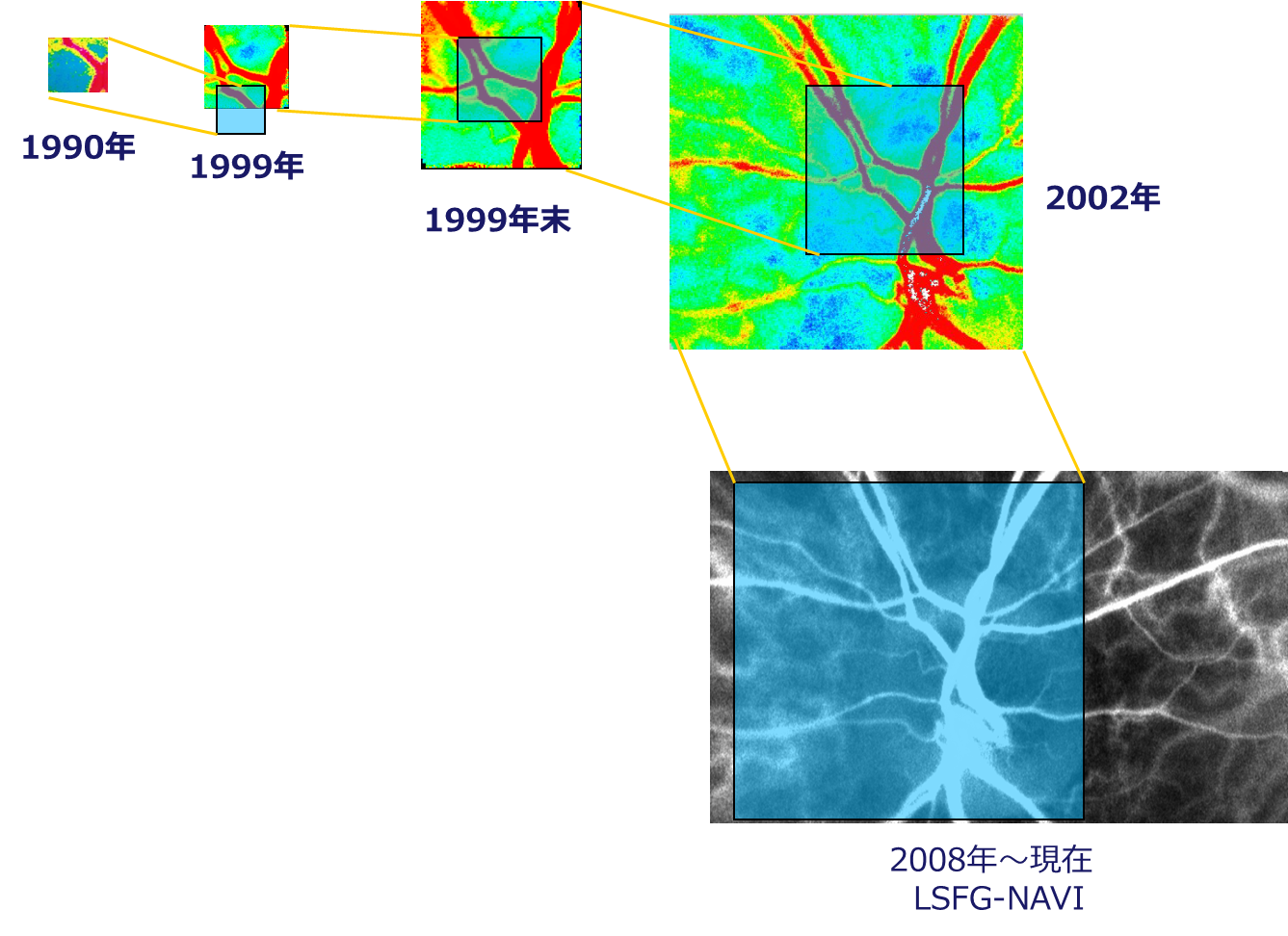 history of blood flow map